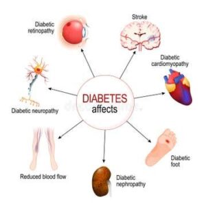 Diabetic Nephropathy